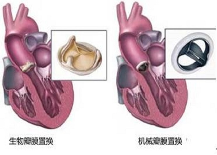 宏觀了解一下醫(yī)用鈦合金